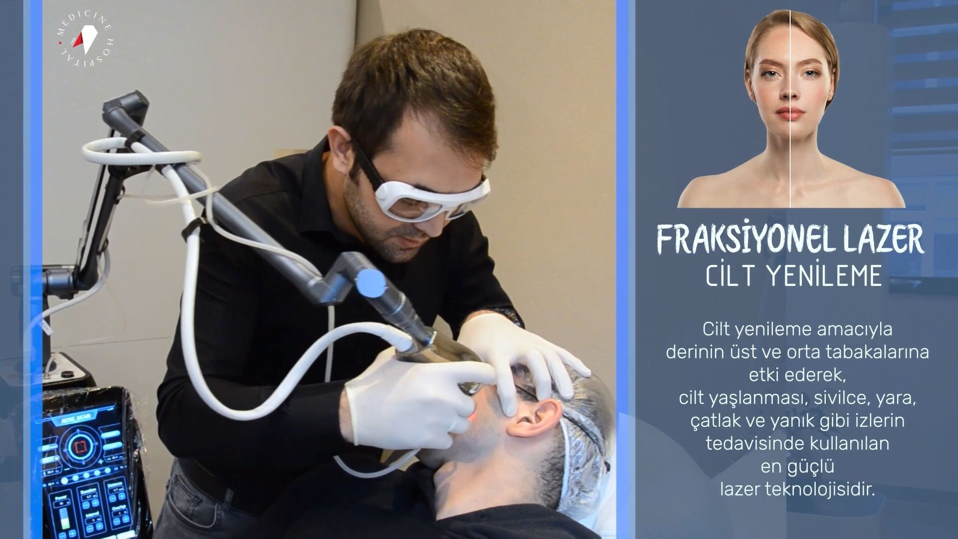 Fraksiyonel Lazer Cilt Yenileme