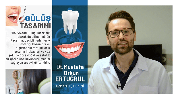 Gulus Tasarimi Nedir