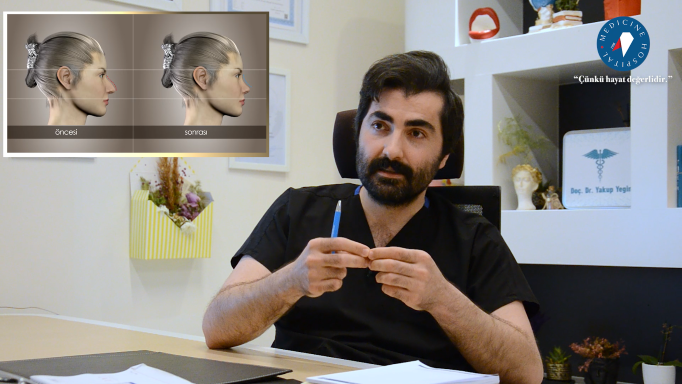 Rinoplasti Soru Cevap Yakup Yegin