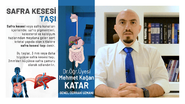 Safra Kesesi Tasi Kagan Katar