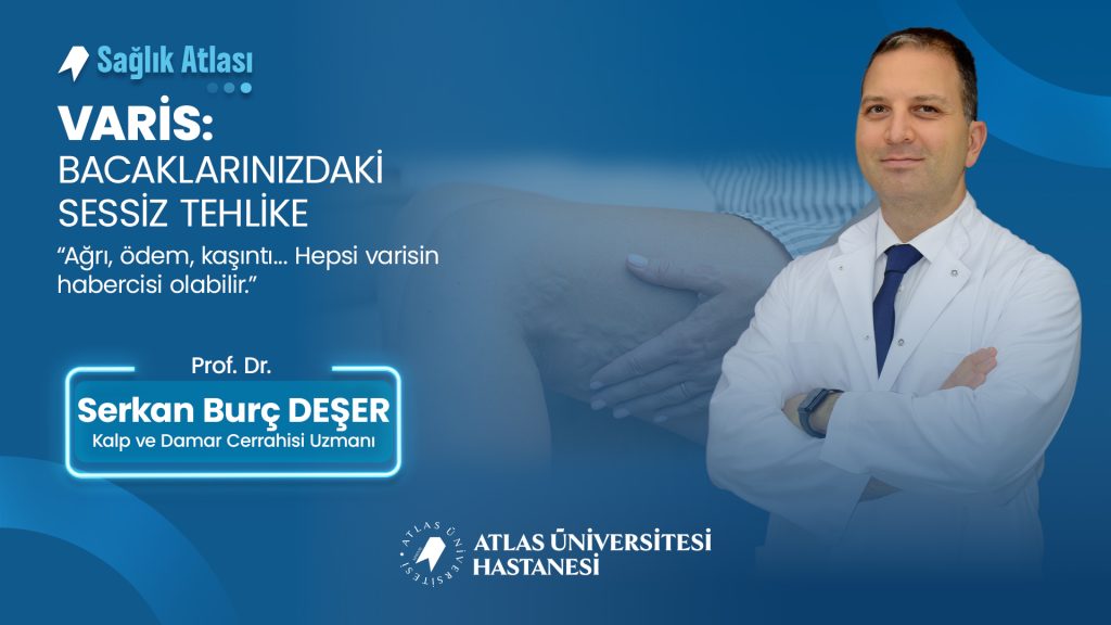 varis bacaklarinizdaki sessiz tehlike agri odem kasinti prof dr serkan burc deser