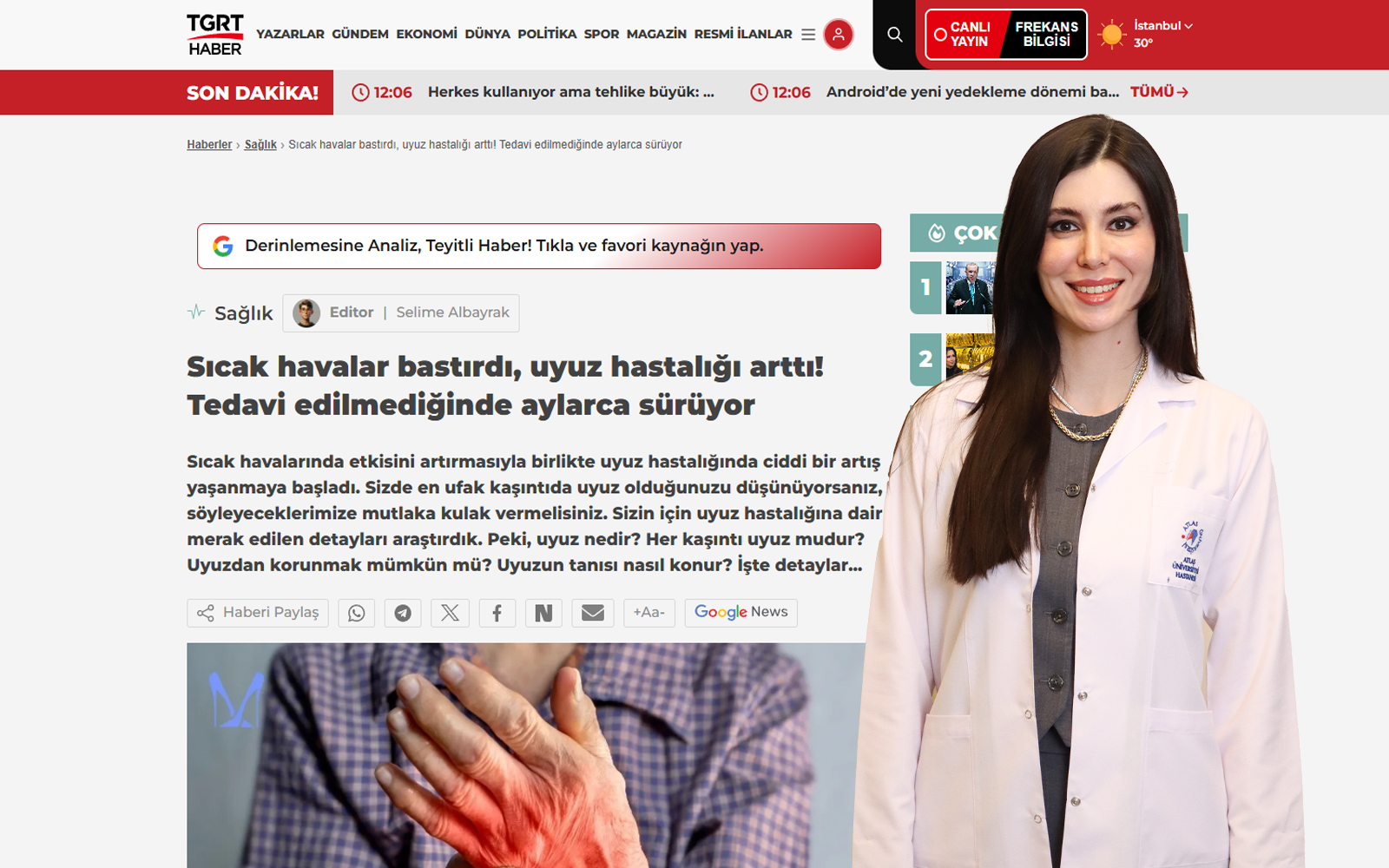 sicak havalar bastirdi uyuz hastaligi artti tedavi edilmediginde aylarca suruyor